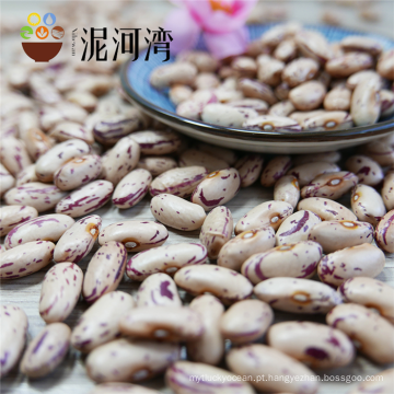Dried Light Speckled Kidney Beans / Pinto Beans With Long or Round Shape
